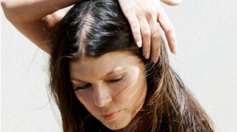 Psoriasi sul cuoio capelluto cos’è?