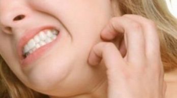 Dermatite da contatto